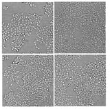 EGFP-fused APP (Amyloid precursor protein) HEK293T Cells